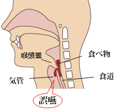 介護 栄養と食事のコラム 誤嚥 ごえん E健康ショップ