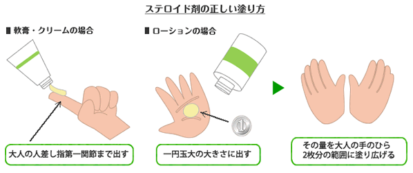 セルフメディケーション 湿疹 かぶれ 皮膚炎の薬 E健康ショップ